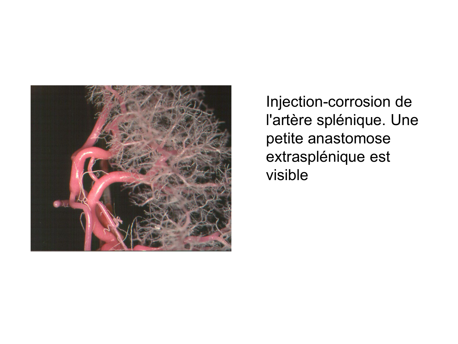 Abdomen gros intestin foie rate pancreas vascularisation page 76
