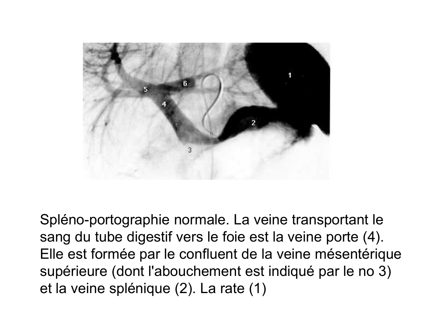 Abdomen gros intestin foie rate pancreas vascularisation page 79