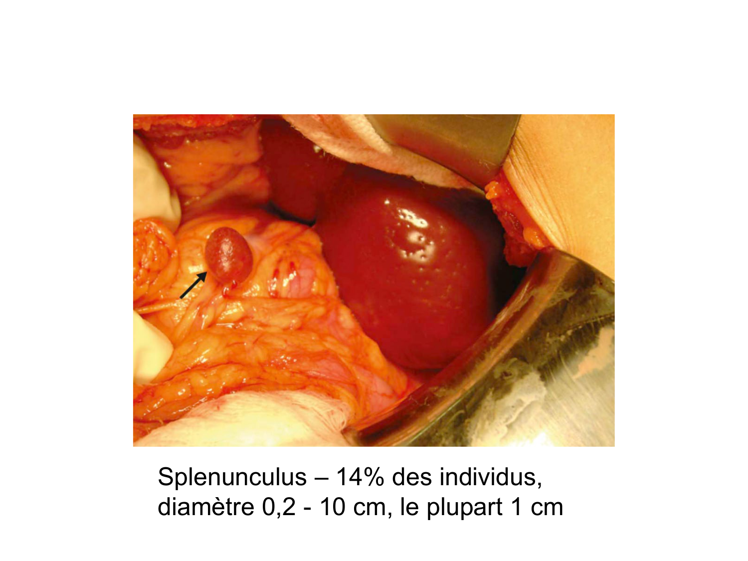 Abdomen gros intestin foie rate pancreas vascularisation page 81