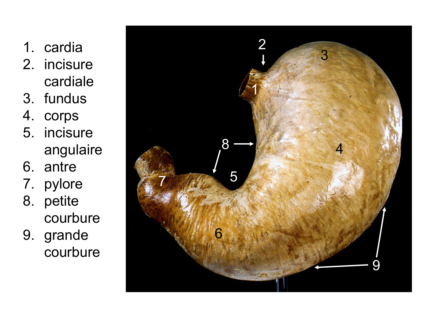 Abdomen paroi cavité tube digestif estomac et intestin grêle page 24