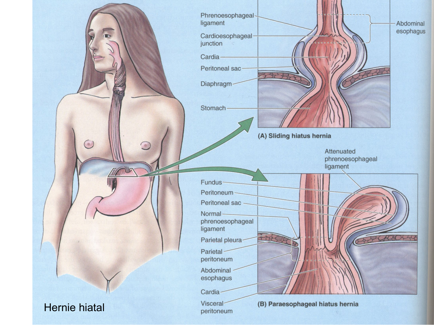 Abdomen paroi cavité tube digestif estomac et intestin grêle page 29