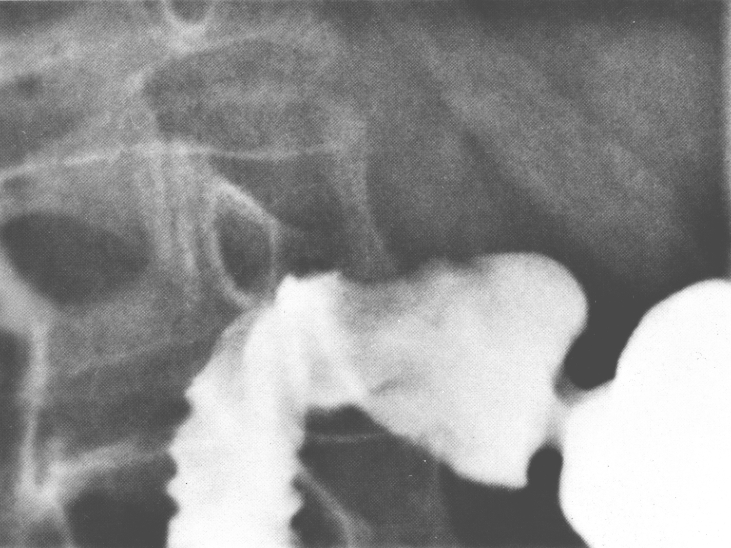 Abdomen paroi cavité tube digestif estomac et intestin grêle page 32