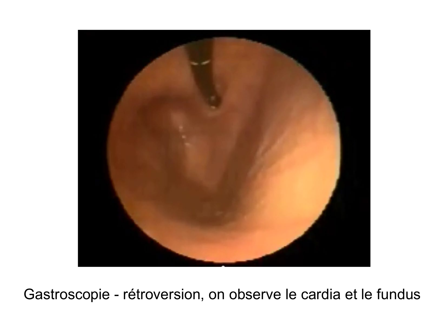 Abdomen paroi cavité tube digestif estomac et intestin grêle page 34