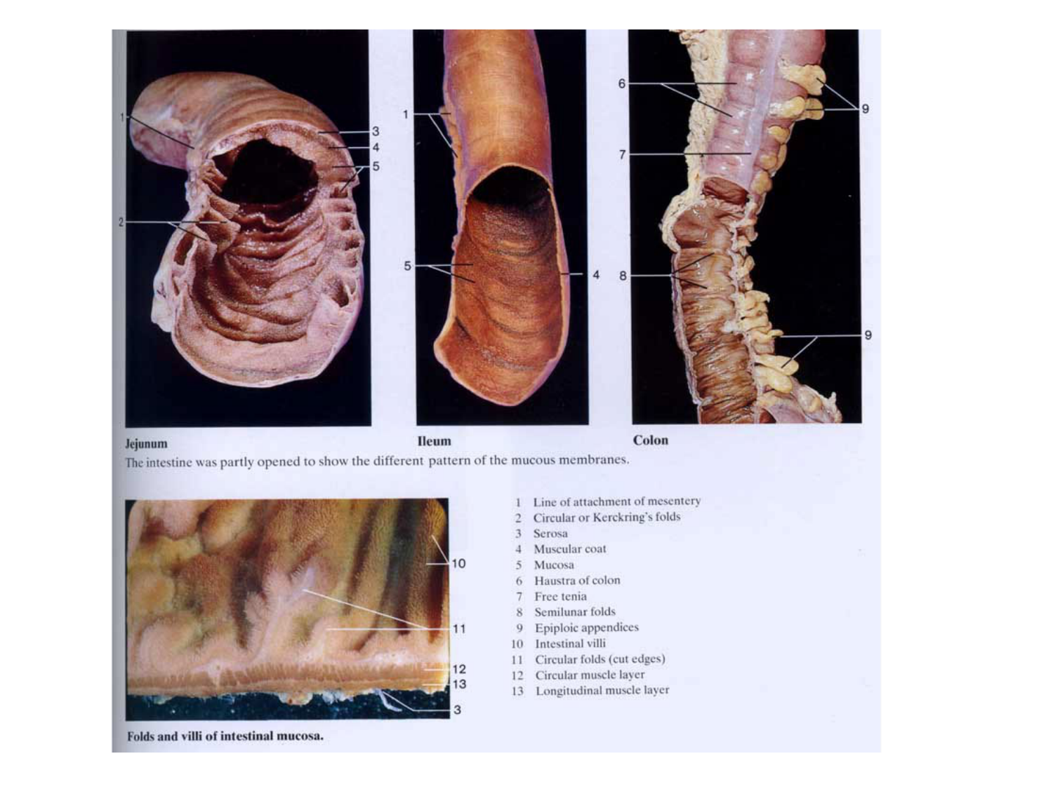 Abdomen paroi cavité tube digestif estomac et intestin grêle page 47