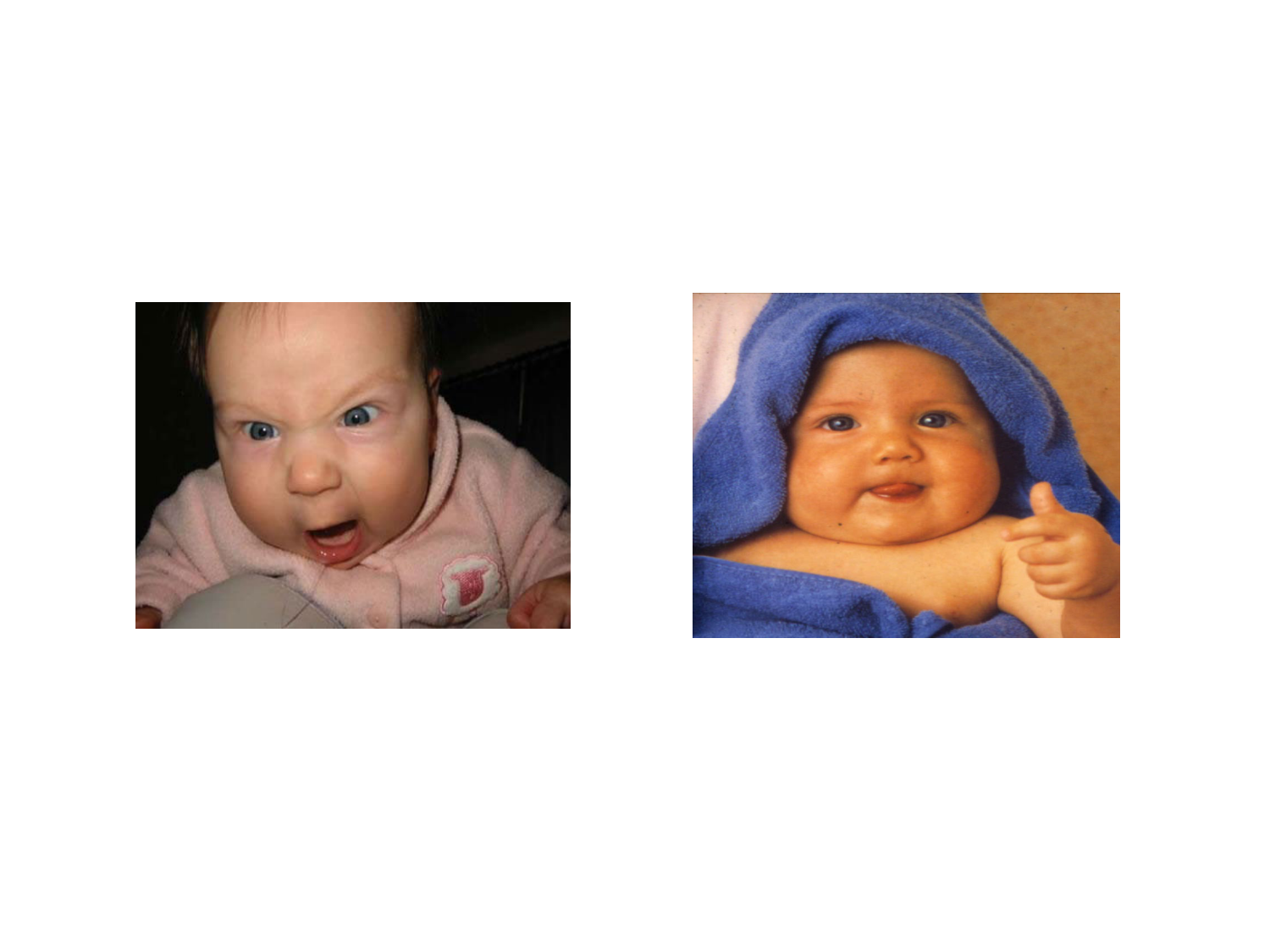 Abdomen paroi cavité tube digestif estomac et intestin grêle page 49