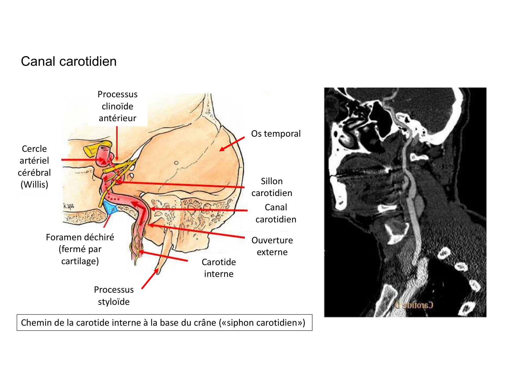 Anatomie de la tete 1 2025 2026 page 44