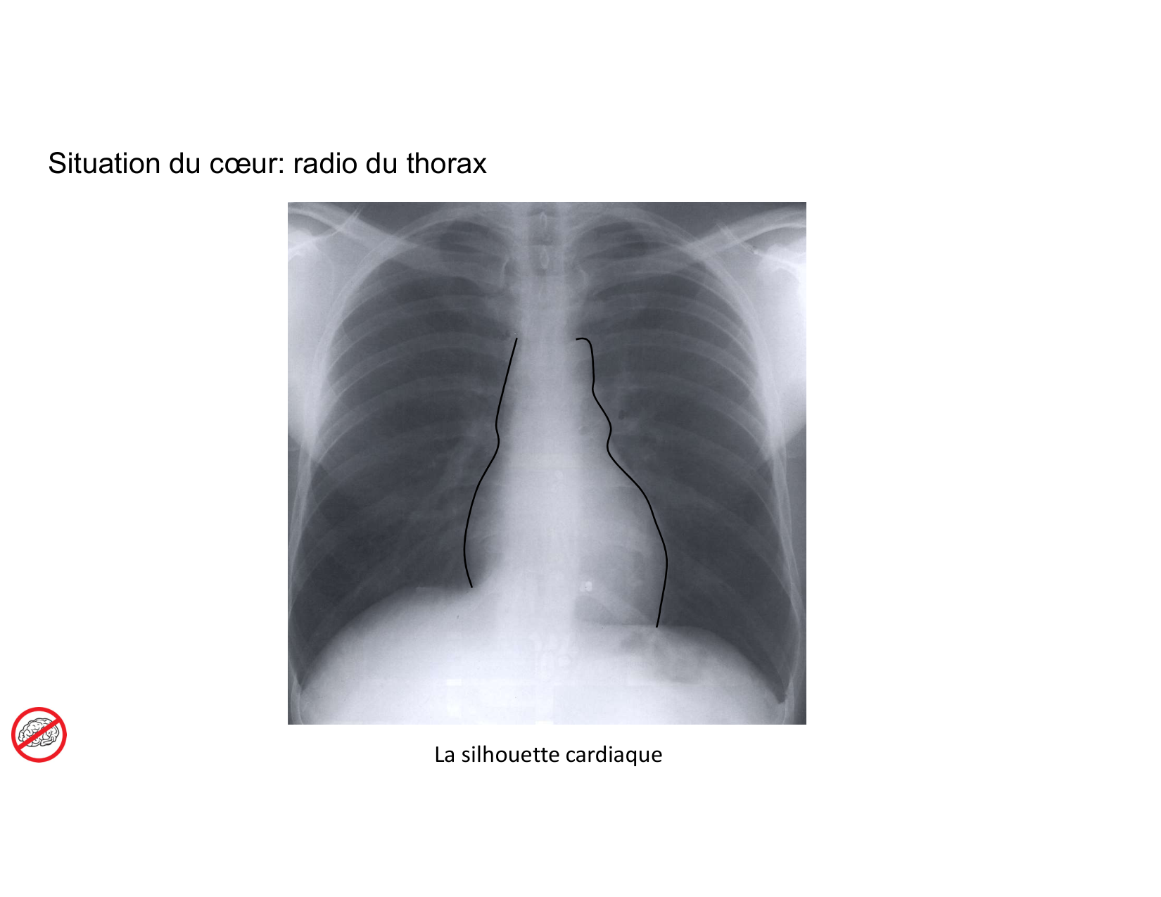 Anatomie du mediastin 2025 2026 page 20