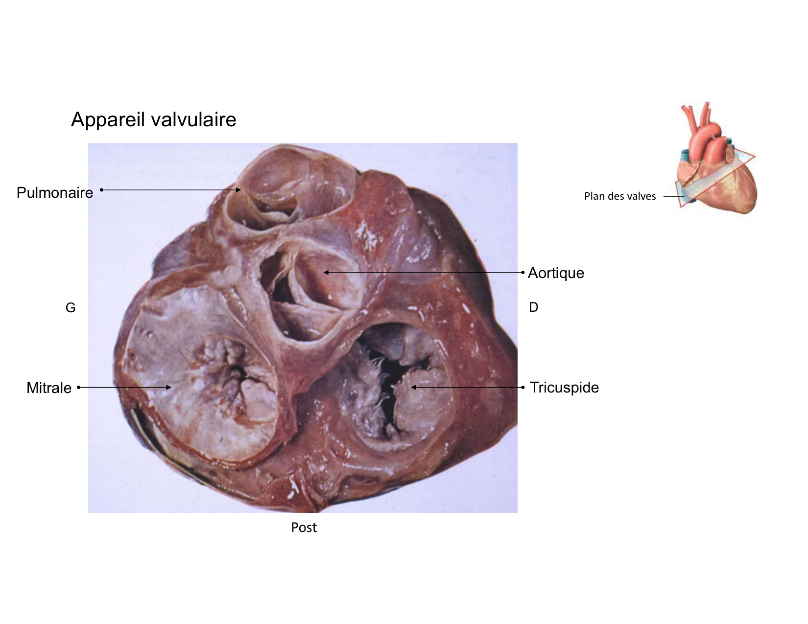 Anatomie du mediastin 2025 2026 page 35