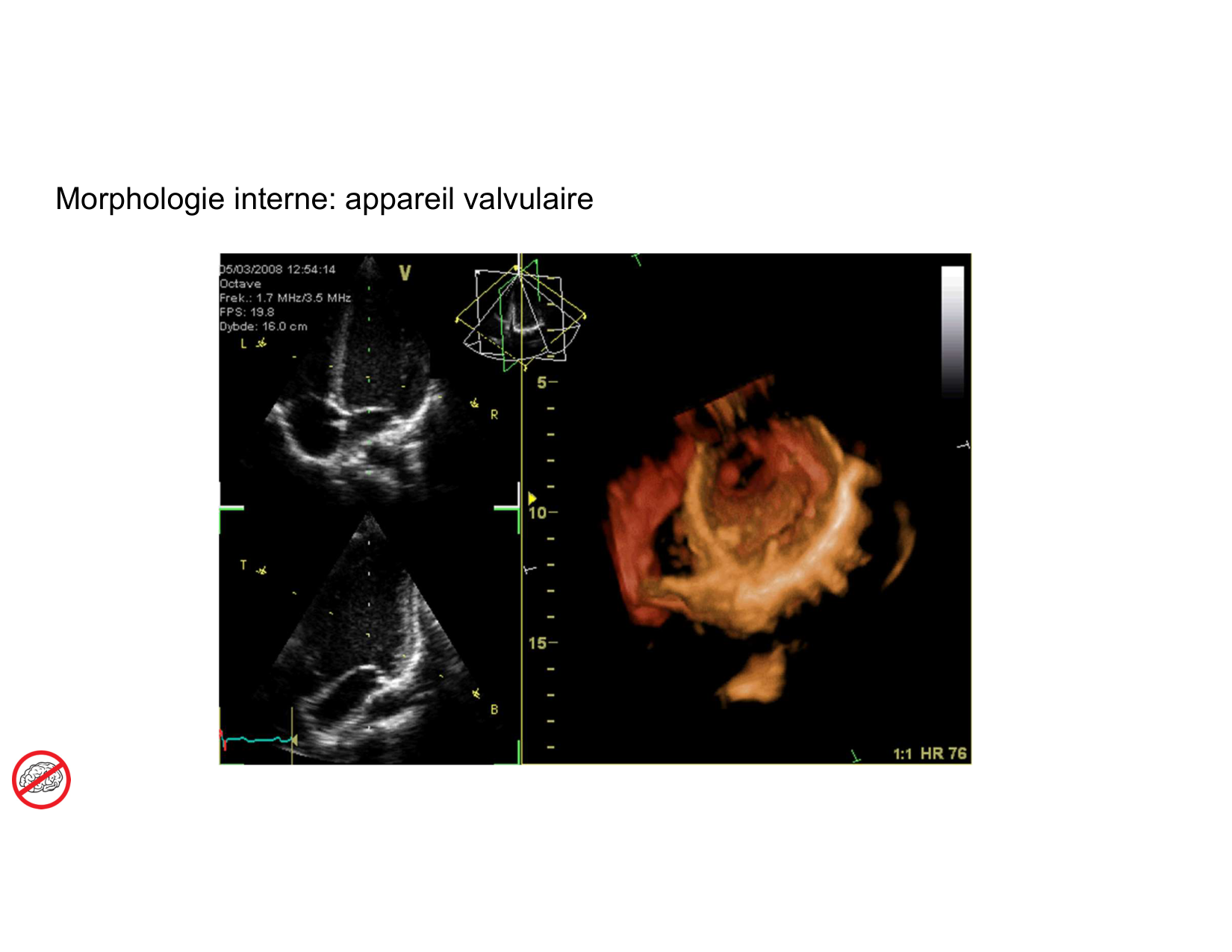 Anatomie du mediastin 2025 2026 page 38