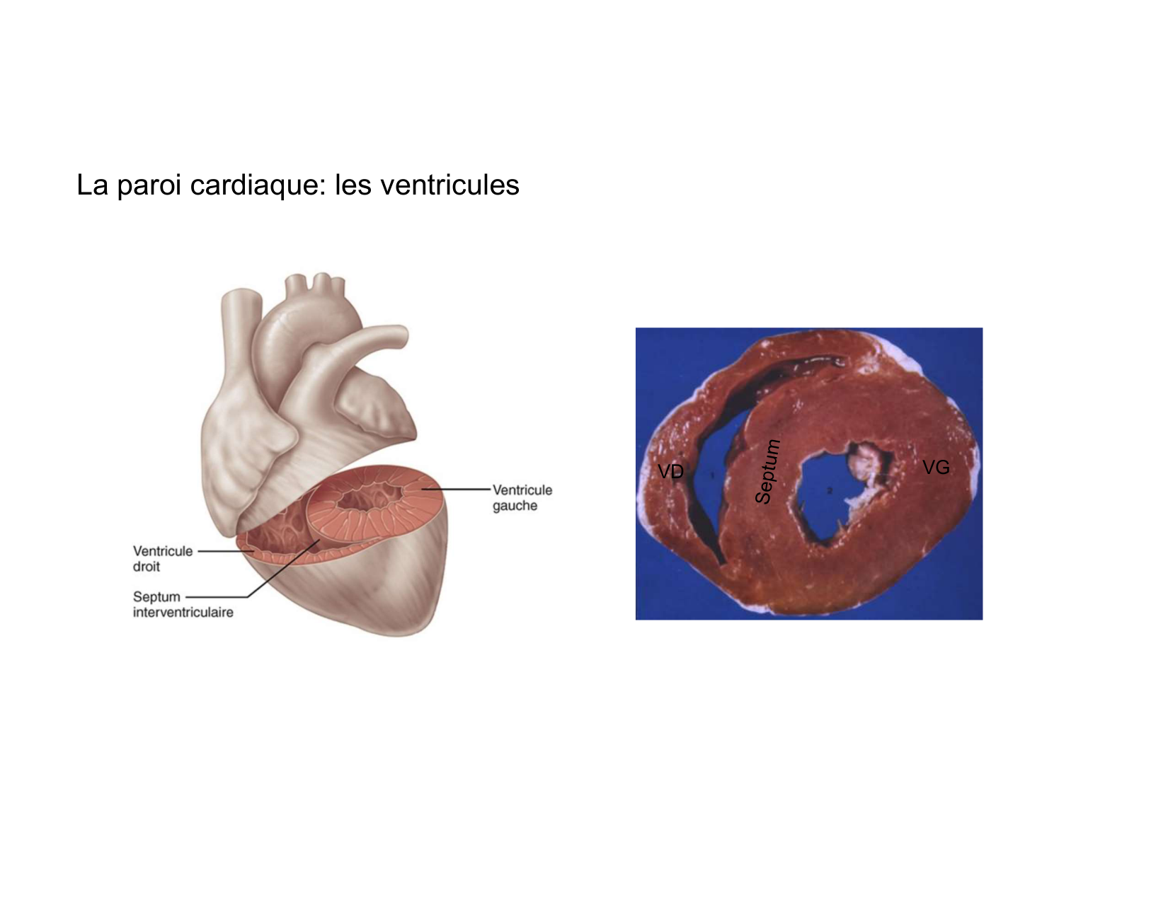 Anatomie du mediastin 2025 2026 page 43