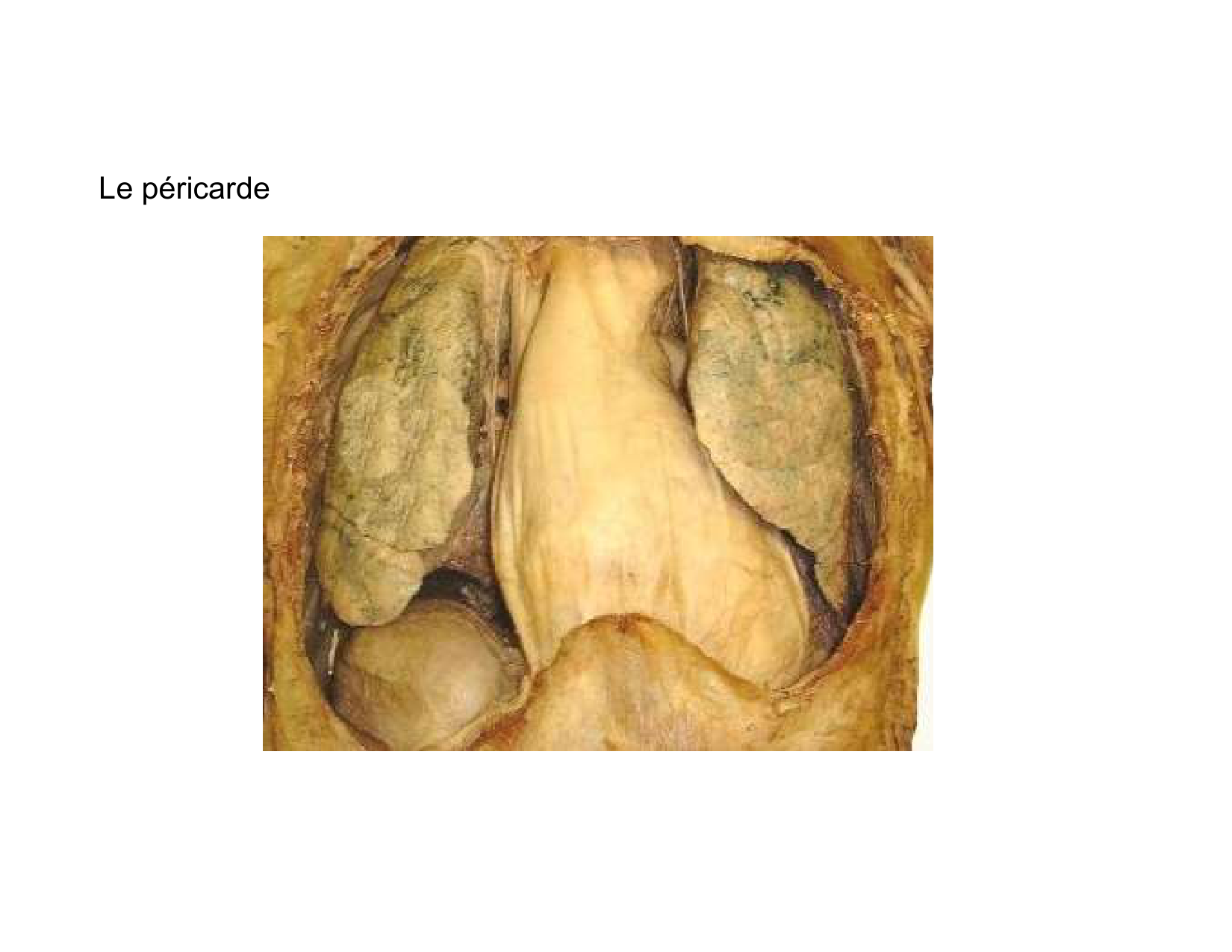 Anatomie du mediastin 2025 2026 page 45