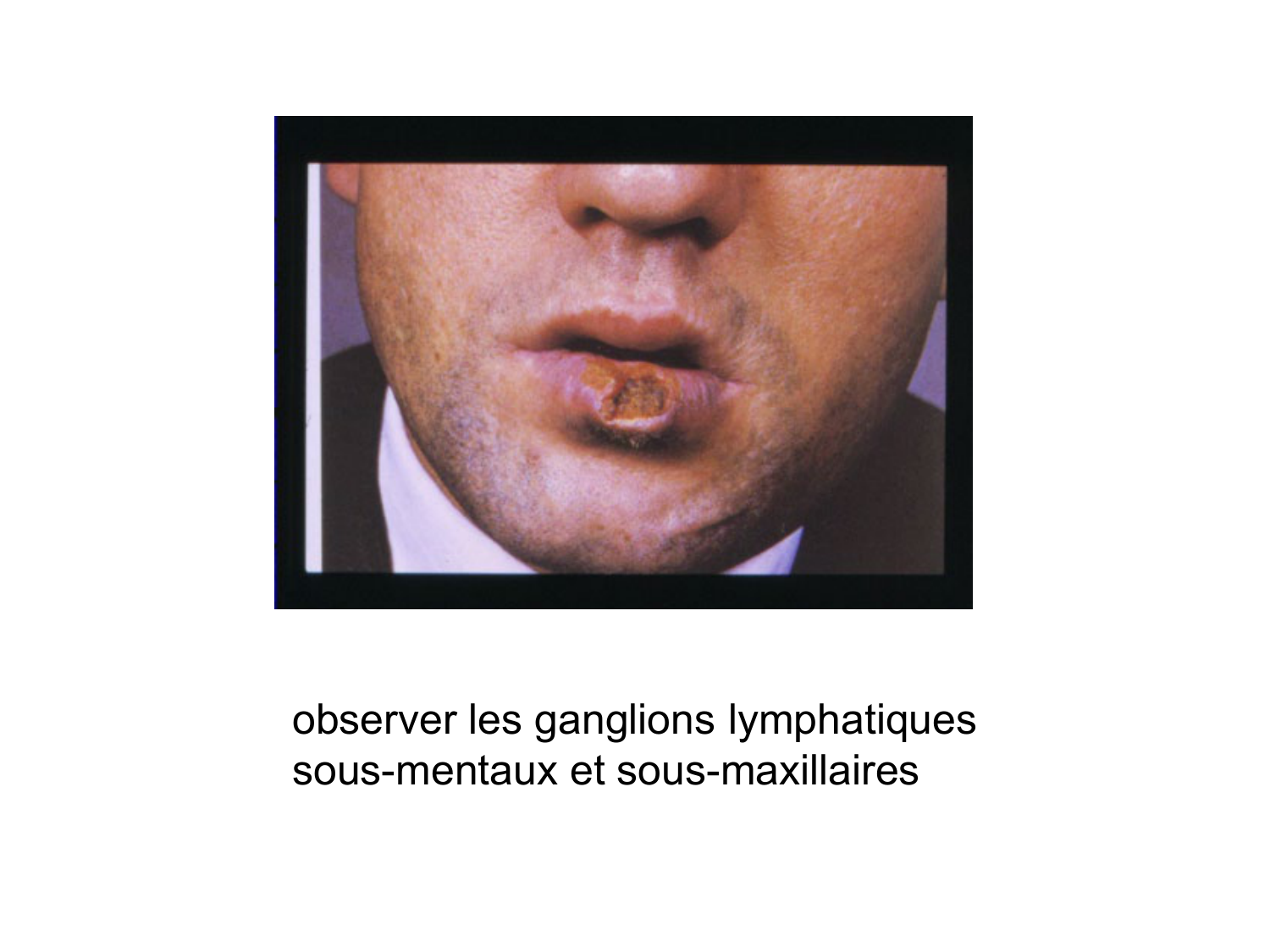 Anatomie du système de défense2 page 24