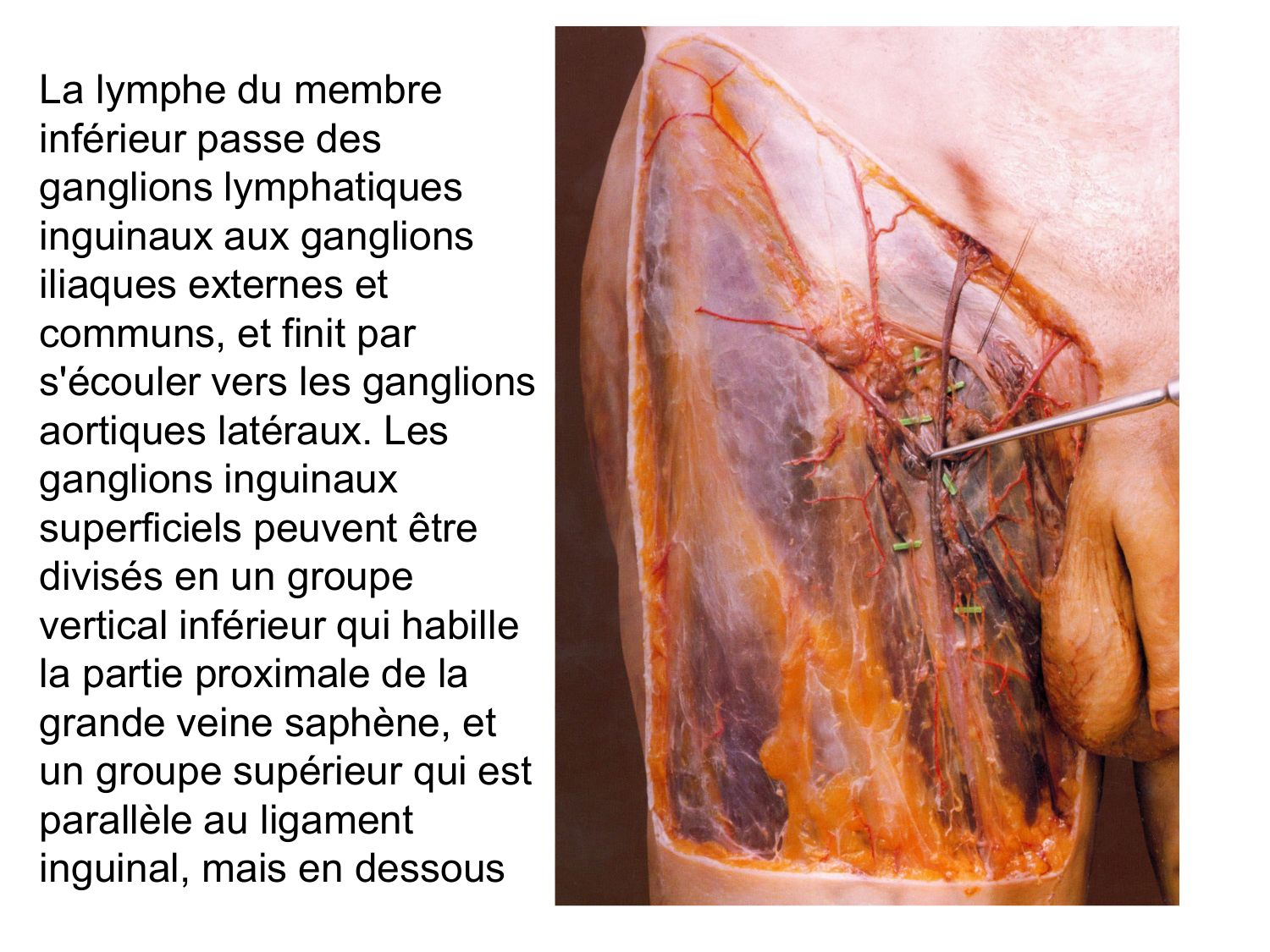 Anatomie du système de défense2 page 35