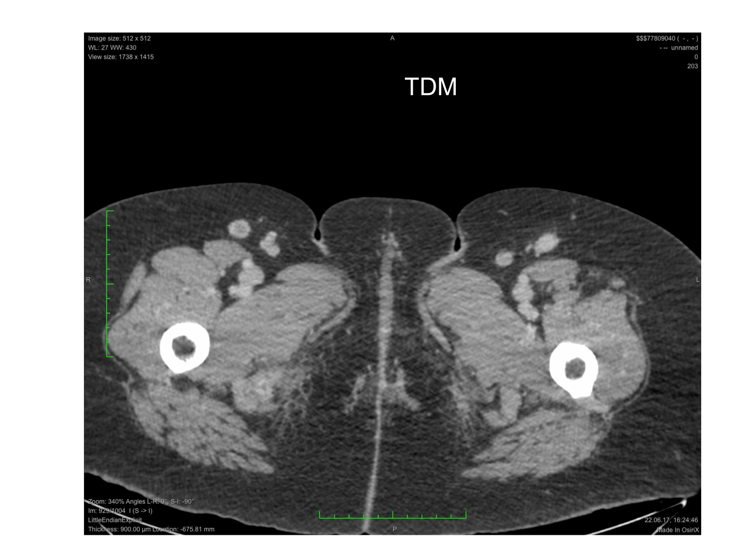 Anatomie du système de défense2 page 38