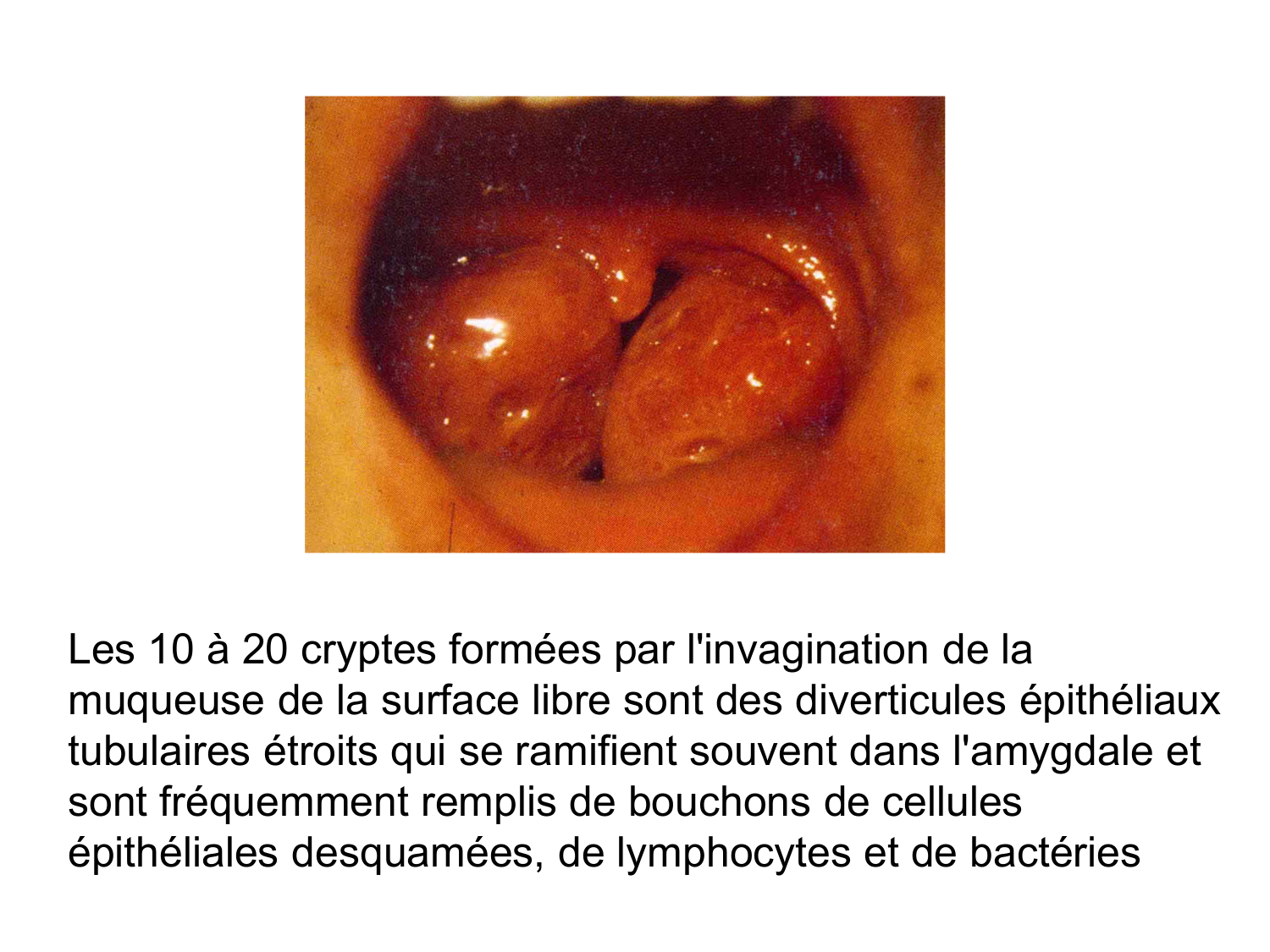 Anatomie du système de défense2 page 49