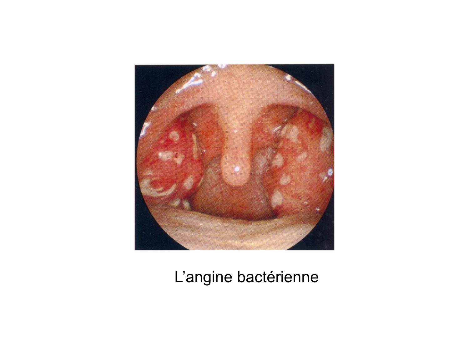 Anatomie du système de défense2 page 51