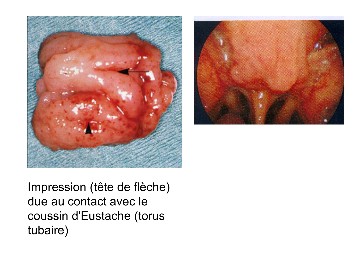 Anatomie du système de défense2 page 61