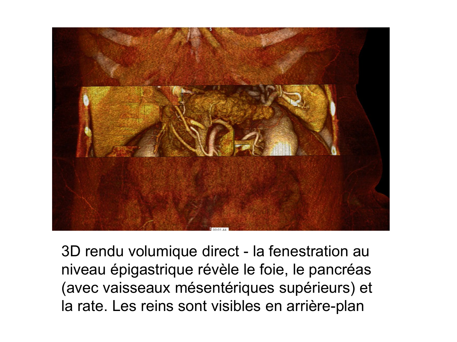Anatomie du système endocrinien2 page 4