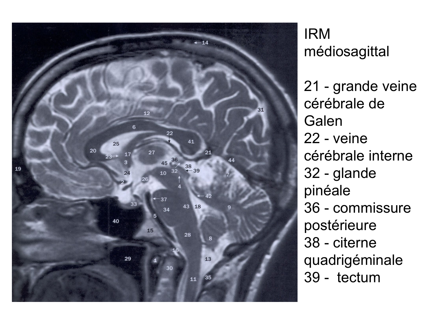 Anatomie du système endocrinien2 page 10