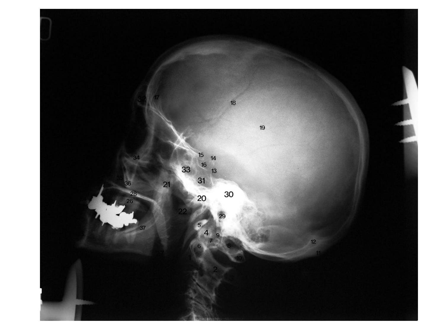 Anatomie du système endocrinien2 page 15
