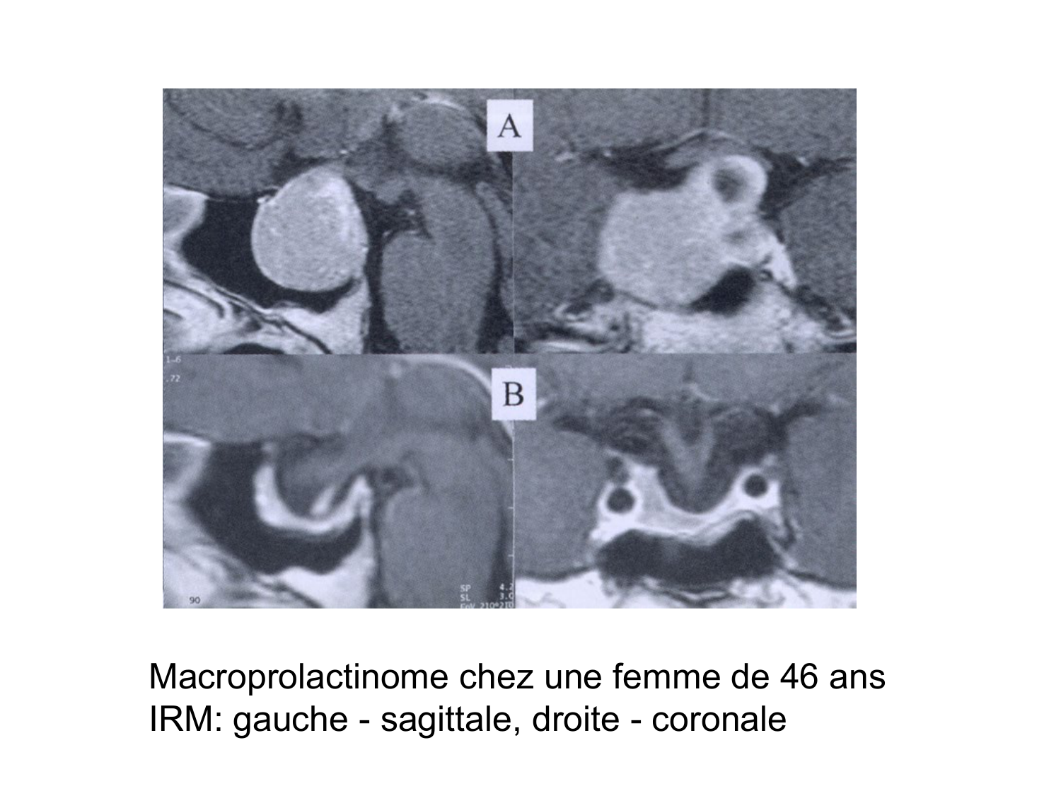Anatomie du système endocrinien2 page 23