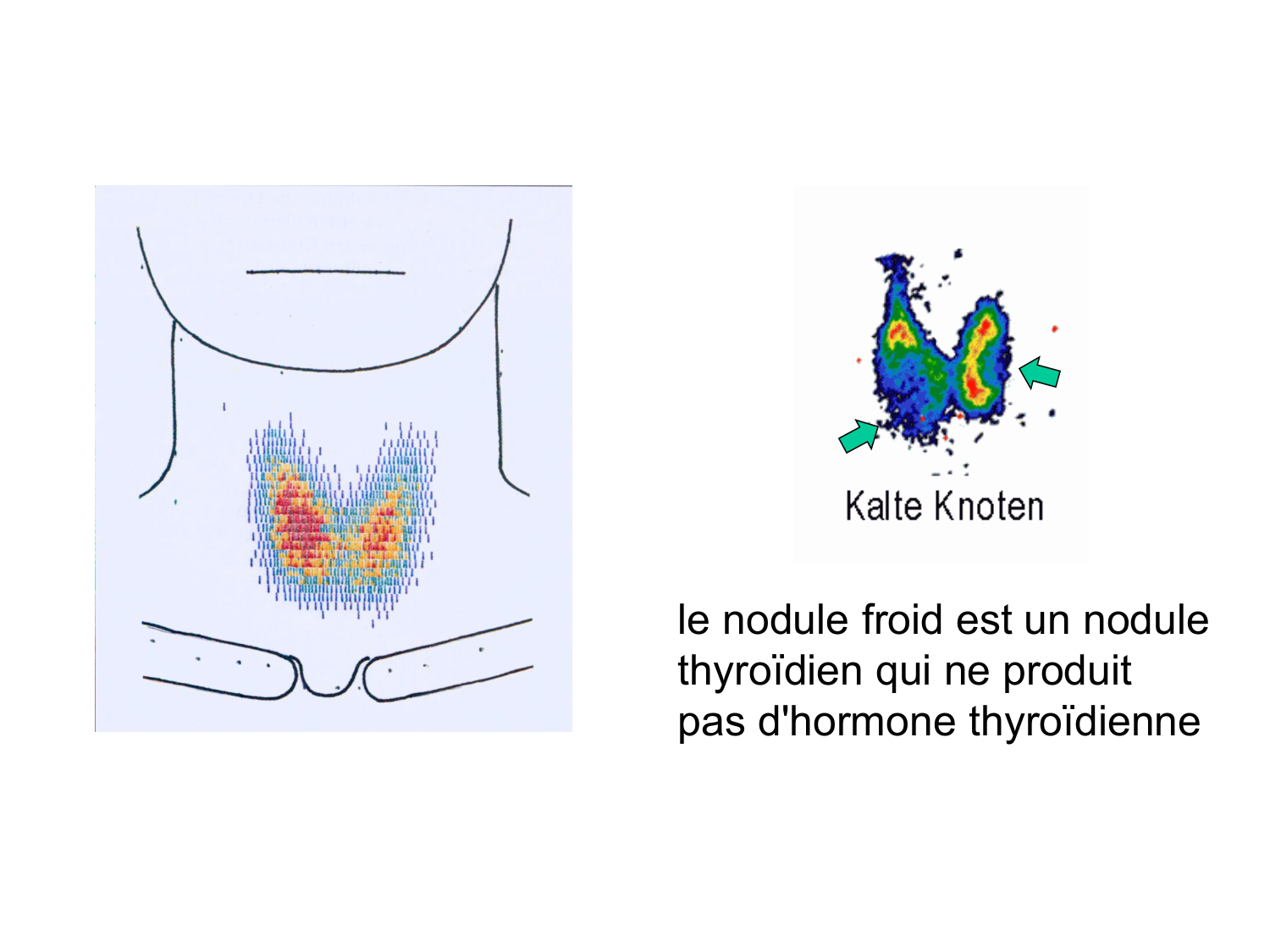 Anatomie du système endocrinien2 page 34