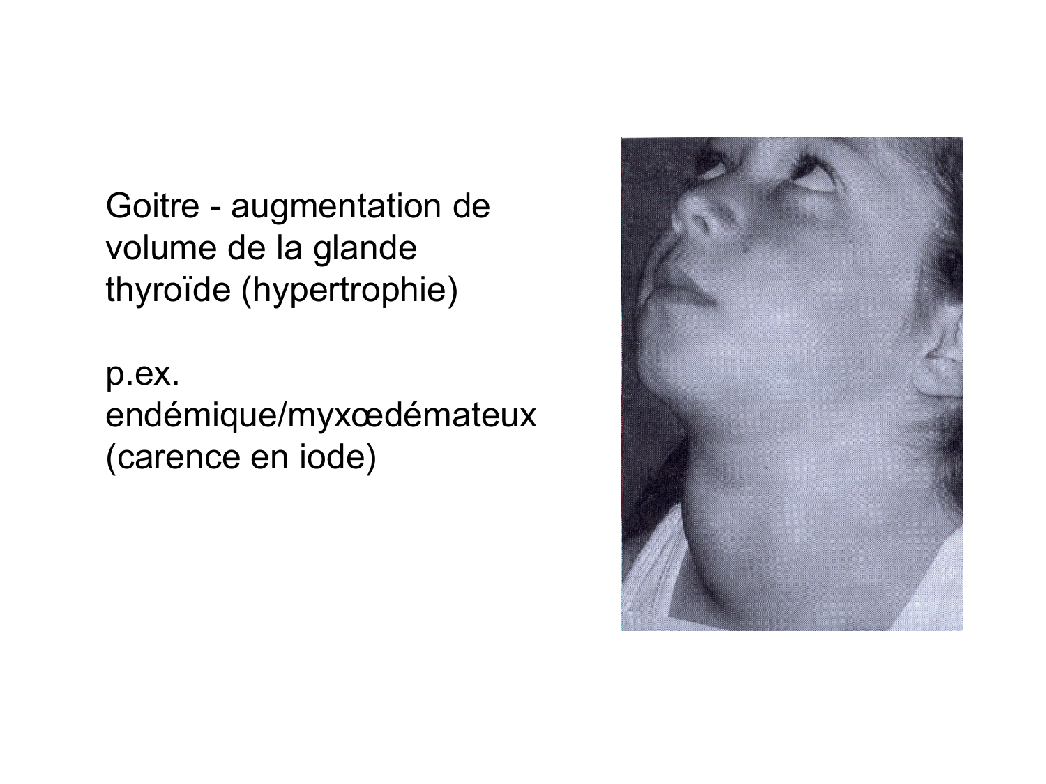 Anatomie du système endocrinien2 page 35