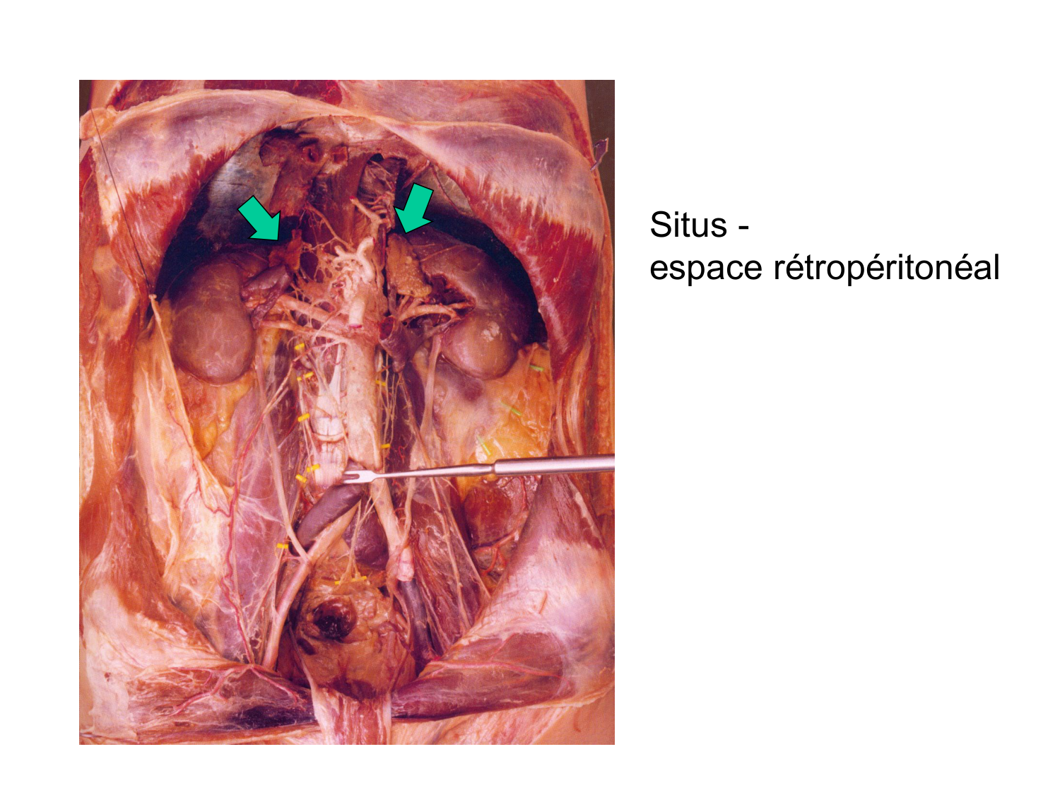 Anatomie du système endocrinien2 page 45