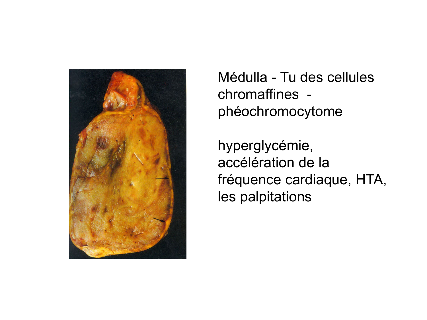 Anatomie du système endocrinien2 page 53