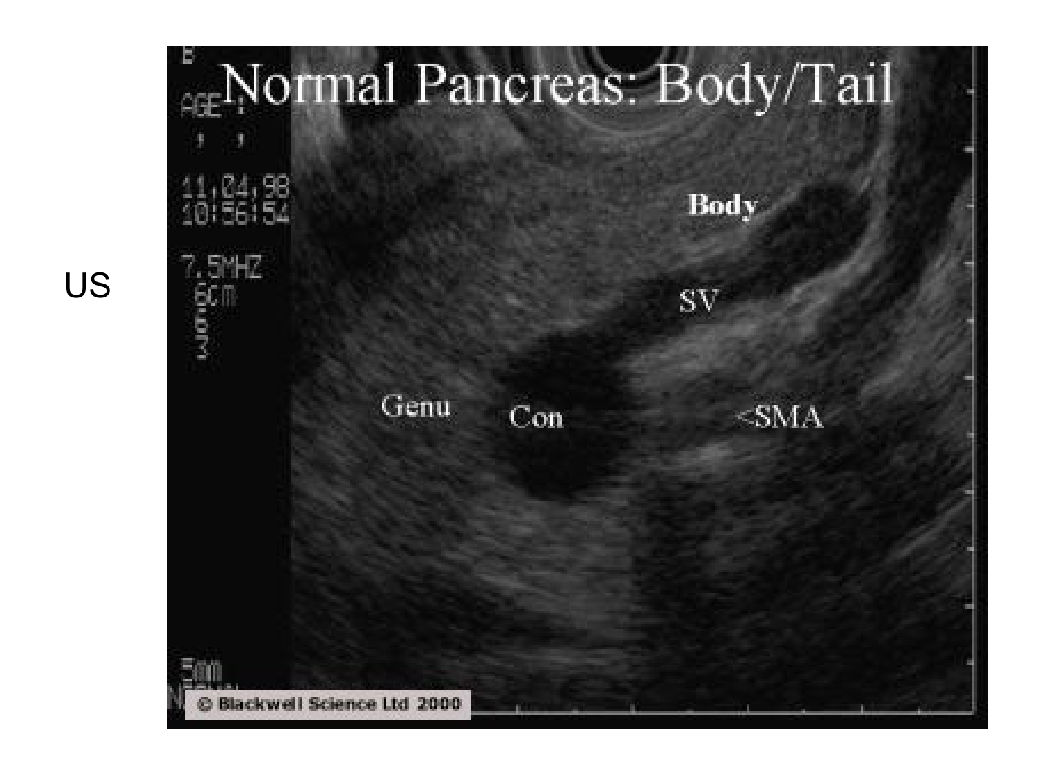 Anatomie du système endocrinien2 page 65