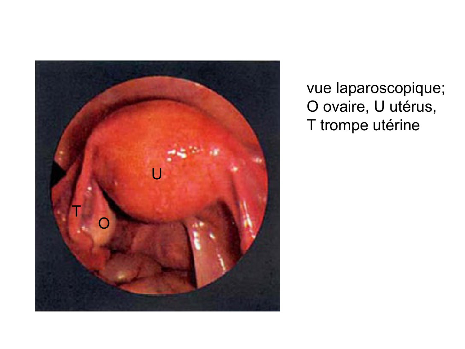 Anatomie du système endocrinien2 page 86
