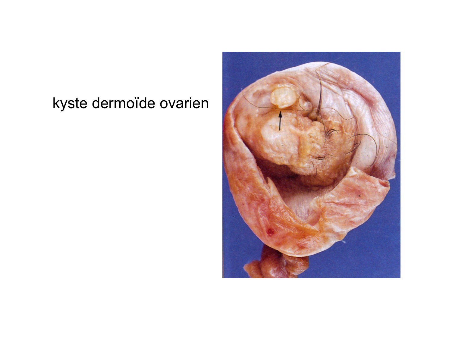 Anatomie du système endocrinien2 page 88