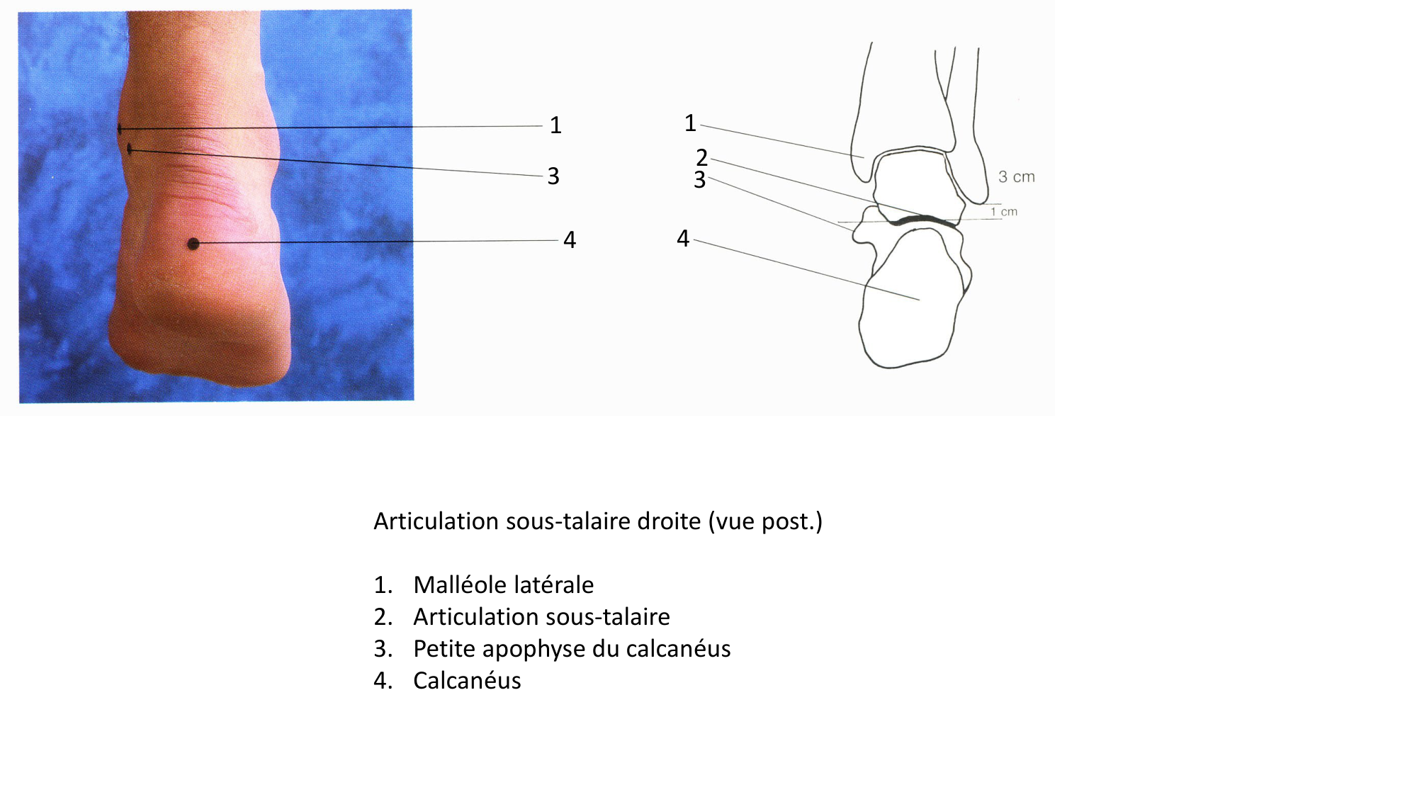 Anatomie palpatoire membre inf page 21