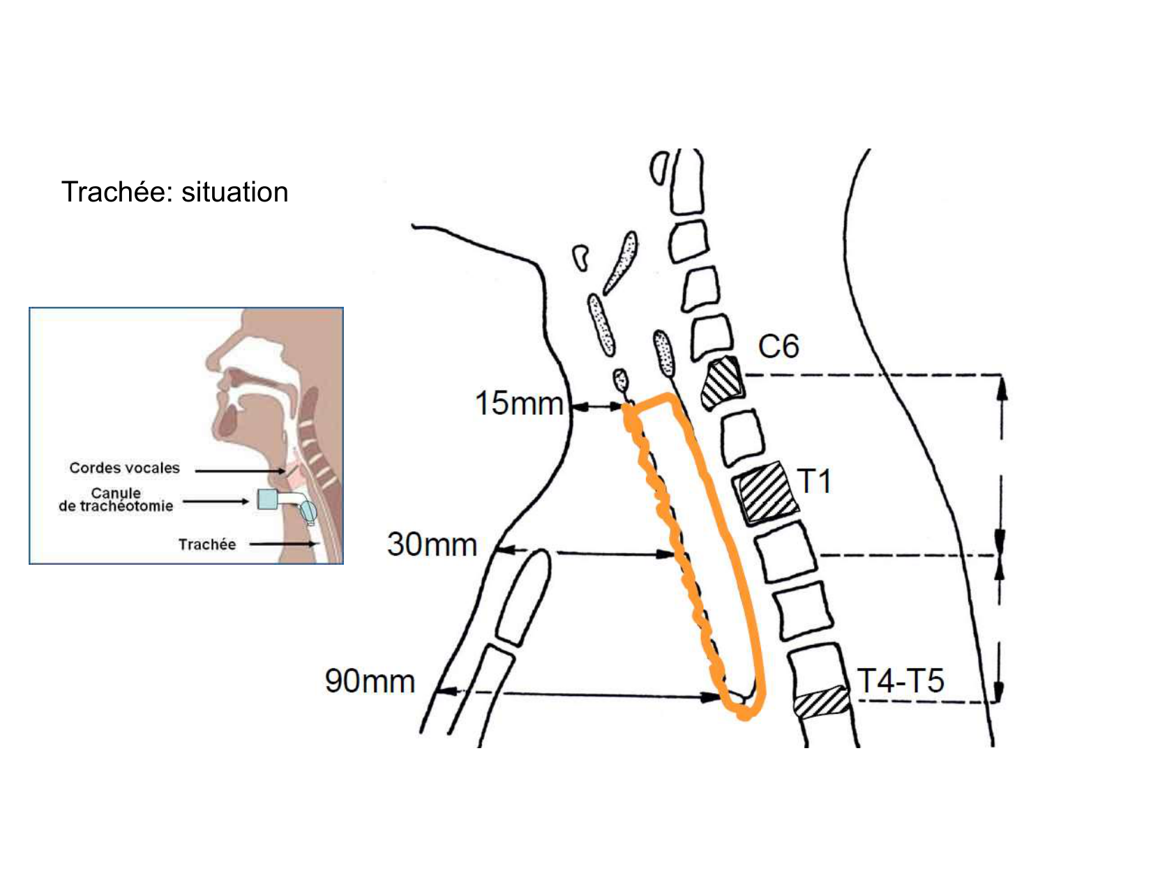 Anatomie pulmonaire 2025 2026 page 10