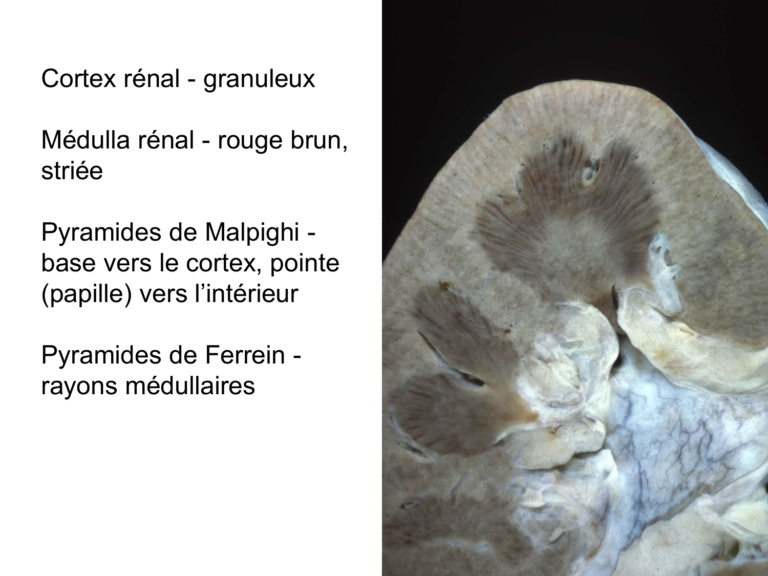 Rein, voies urinaires et retropéritoine page 25