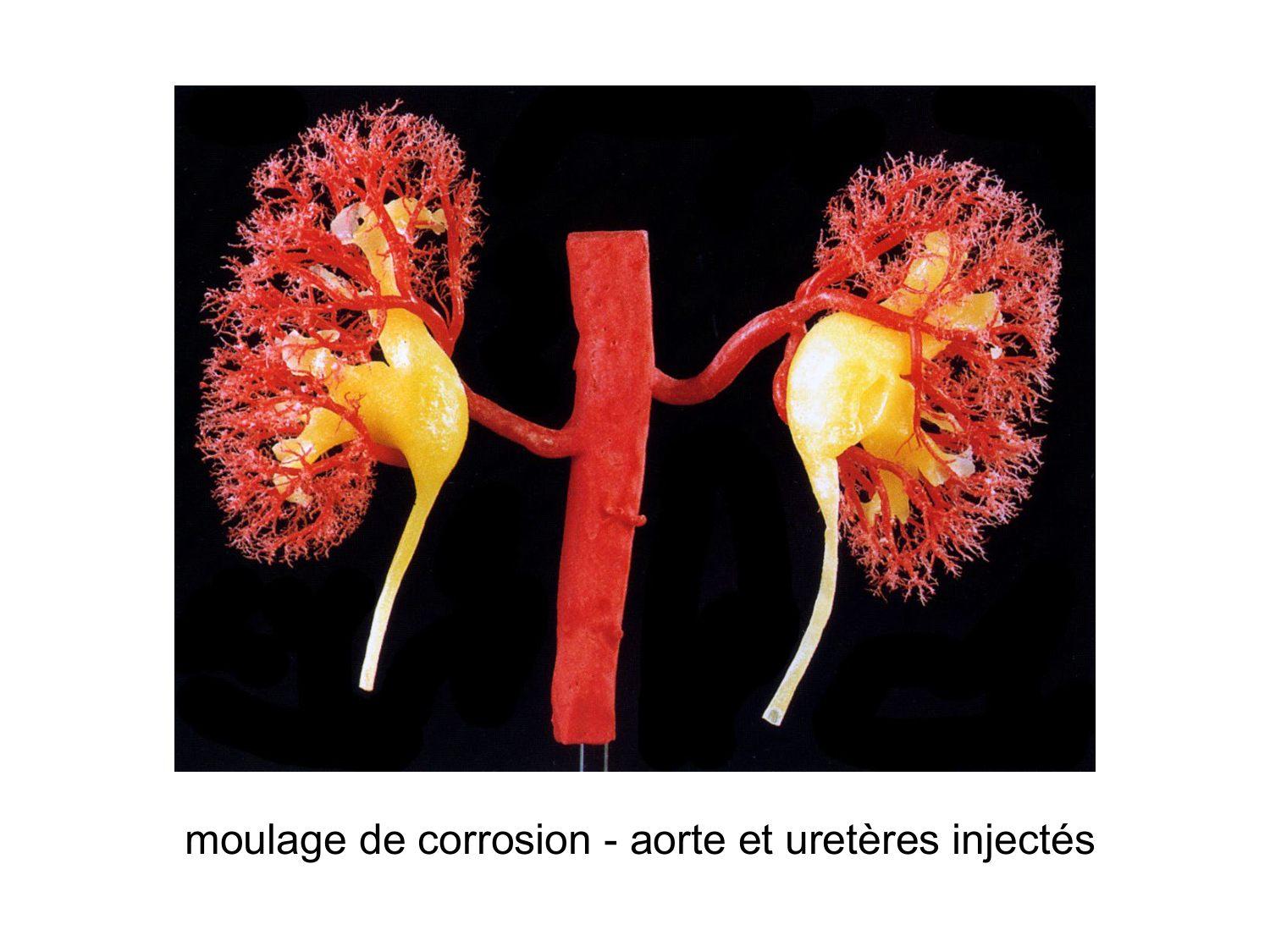 Rein, voies urinaires et retropéritoine page 29