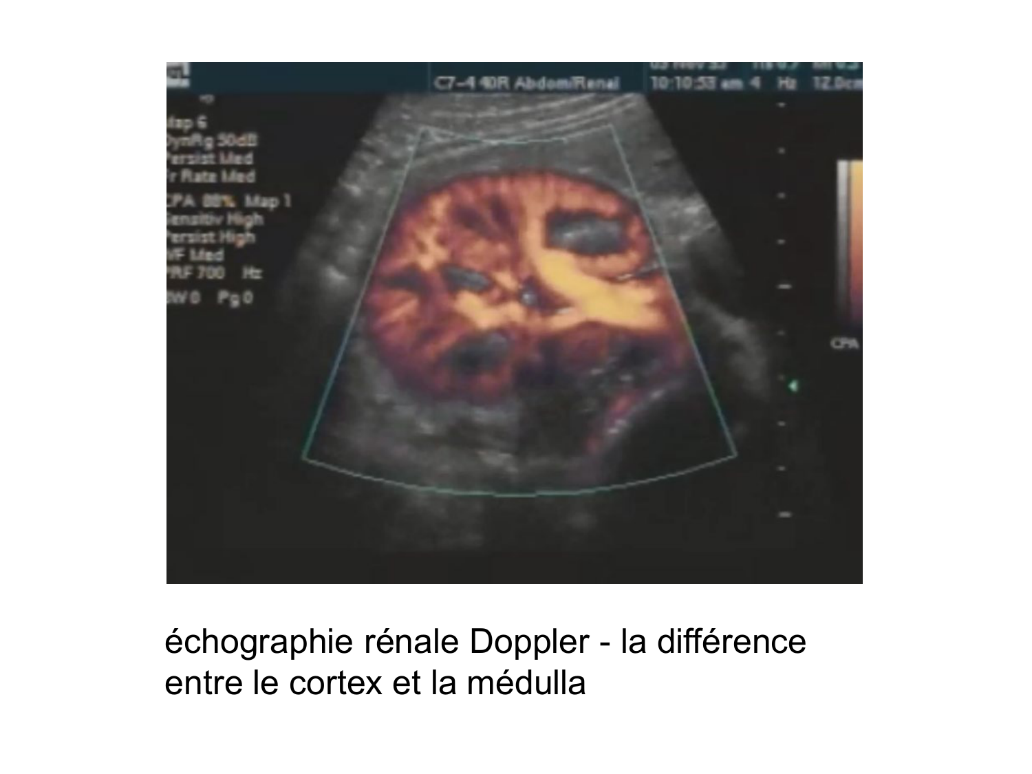 Rein, voies urinaires et retropéritoine page 33