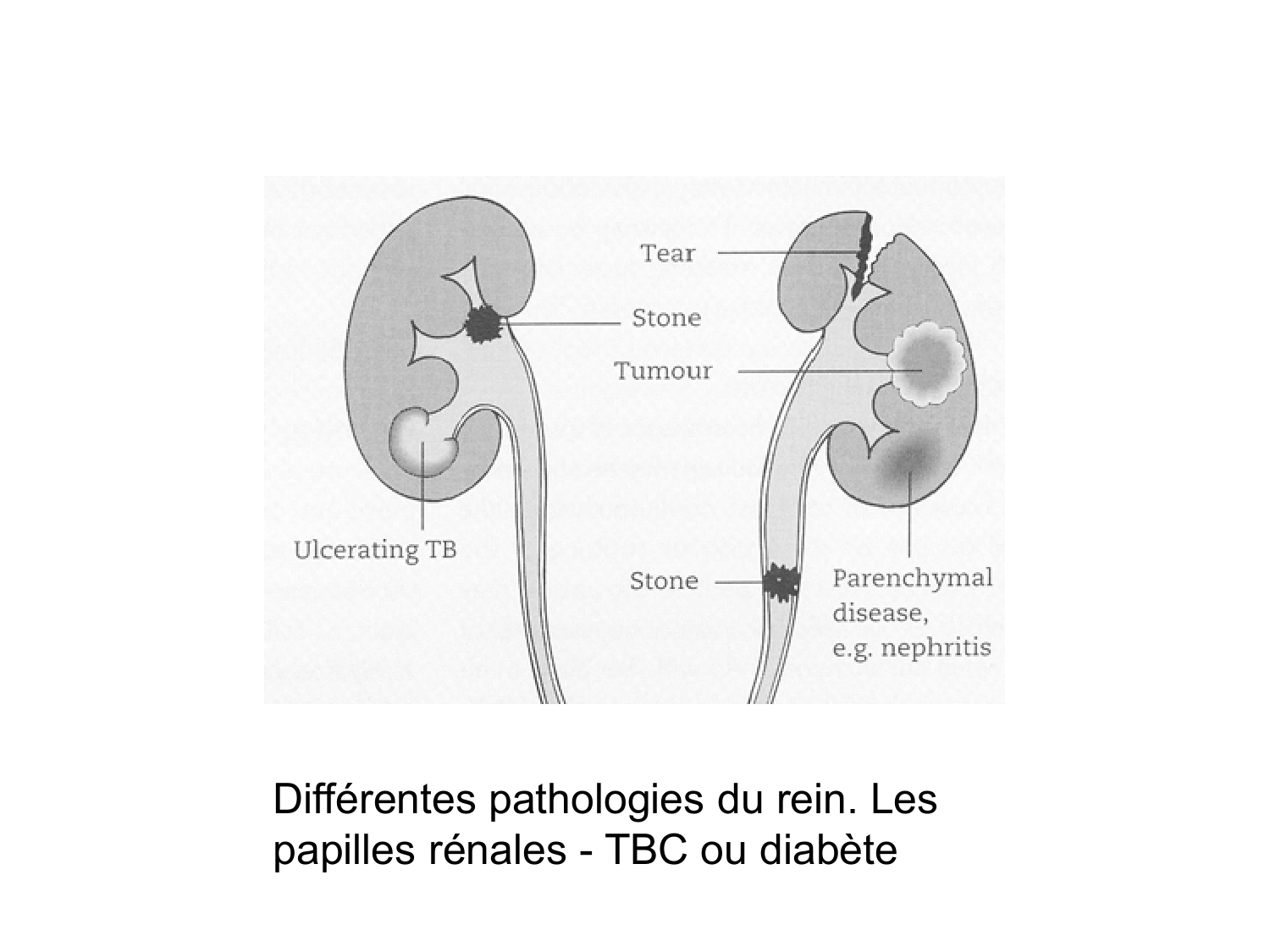 Rein, voies urinaires et retropéritoine page 38