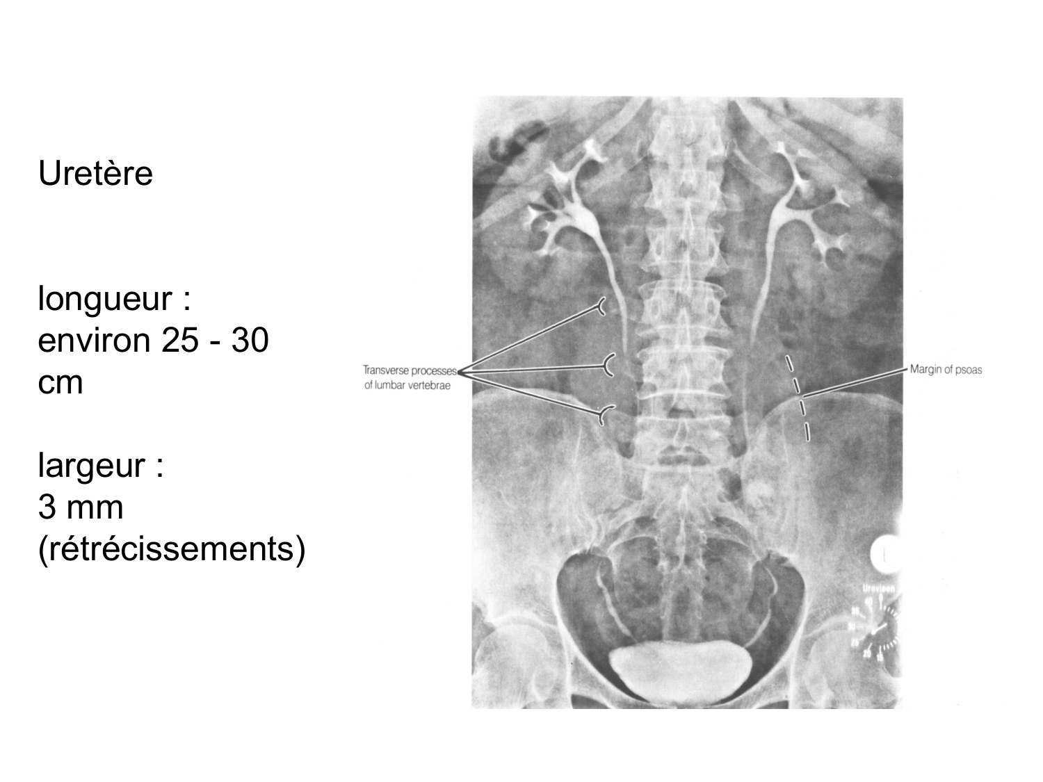 Rein, voies urinaires et retropéritoine page 47