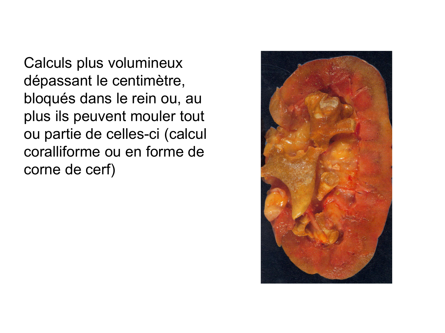 Rein, voies urinaires et retropéritoine page 52
