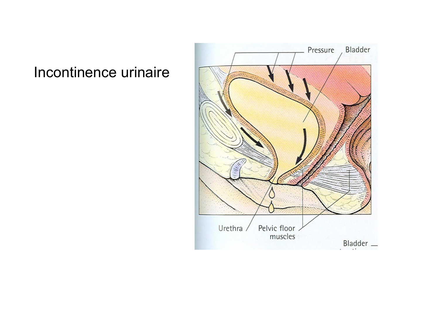 Rein, voies urinaires et retropéritoine page 71