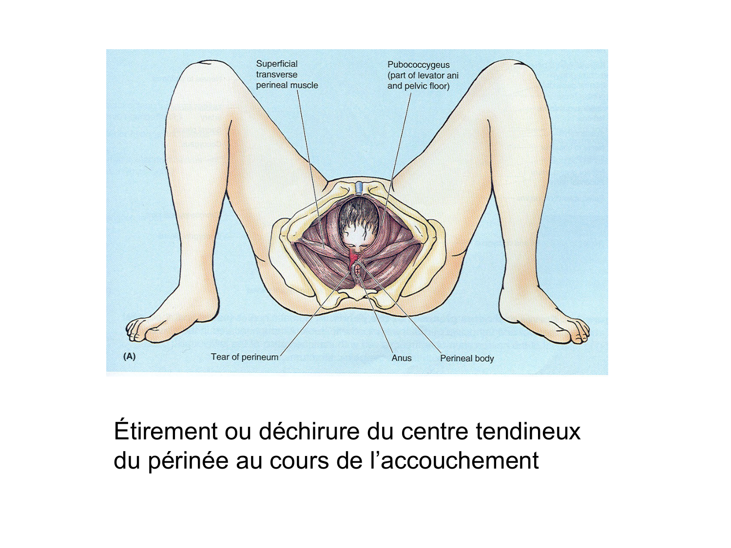 Rein, voies urinaires et retropéritoine page 72