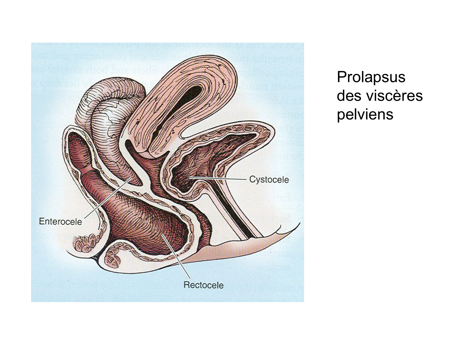 Rein, voies urinaires et retropéritoine page 74