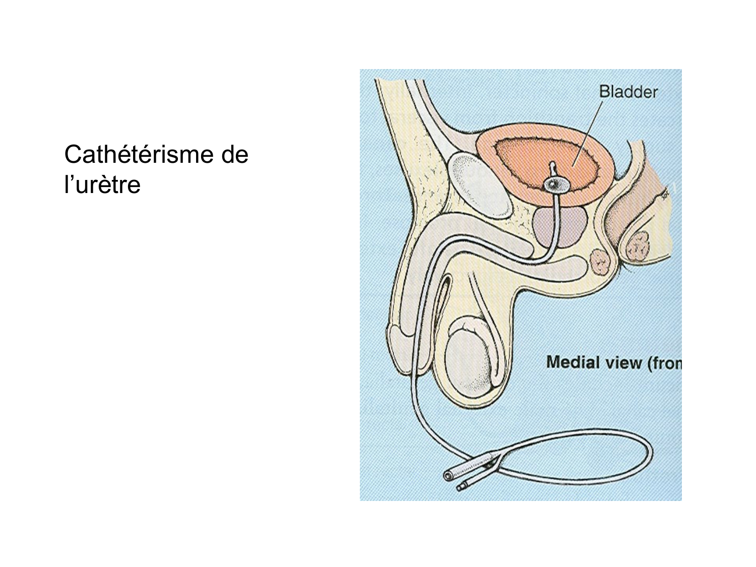Rein, voies urinaires et retropéritoine page 81