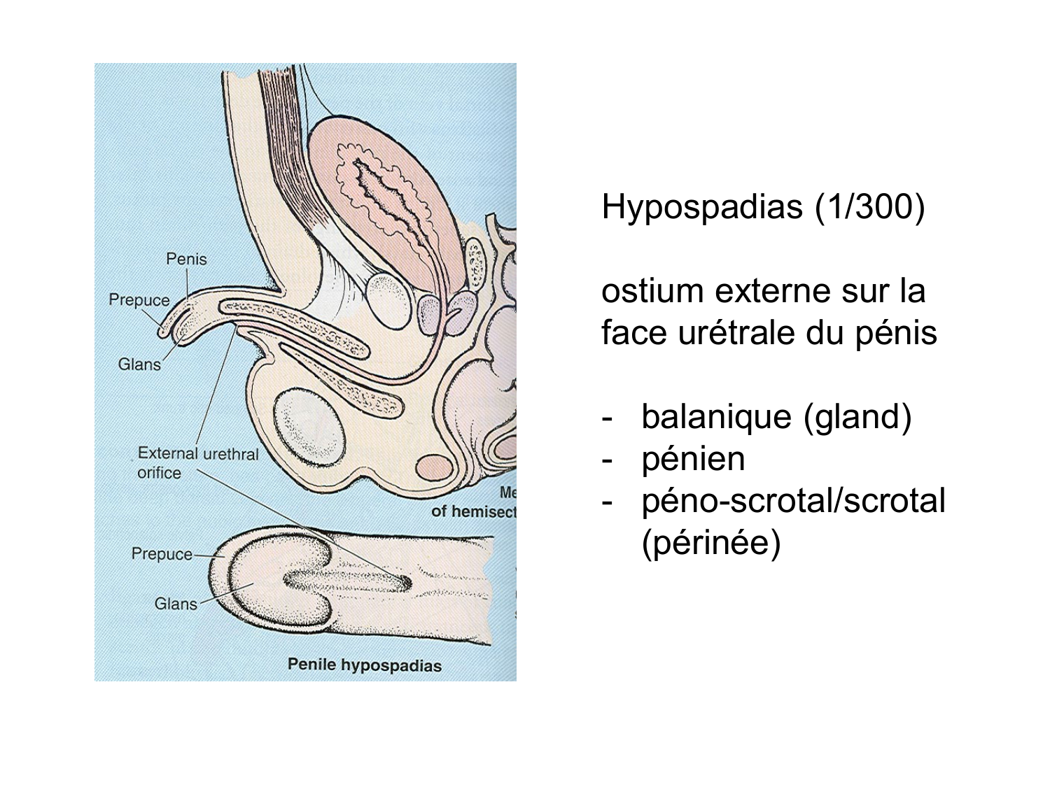 Rein, voies urinaires et retropéritoine page 86