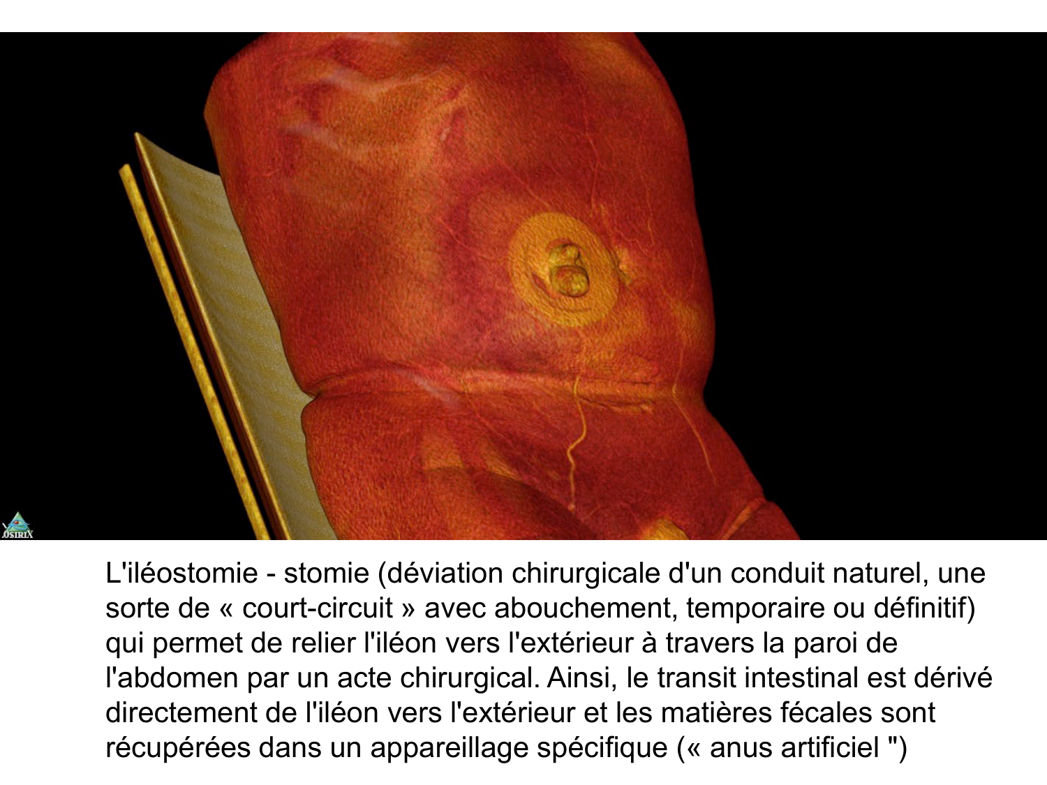Splanchnologie generale; Pelvis-Perinée système reproducteur (homme et femme)1 page 3