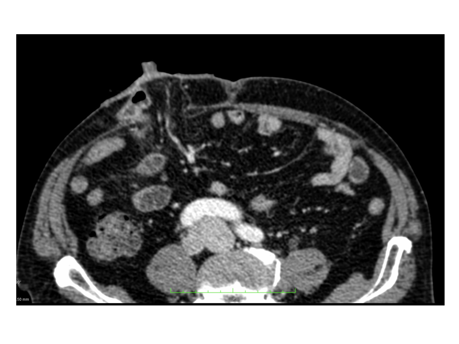 Splanchnologie generale; Pelvis-Perinée système reproducteur (homme et femme)1 page 4