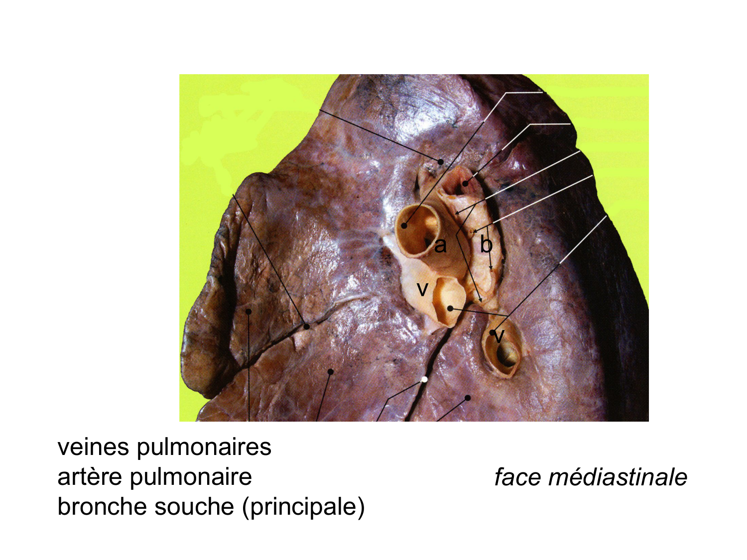 Splanchnologie generale; Pelvis-Perinée système reproducteur (homme et femme)1 page 13