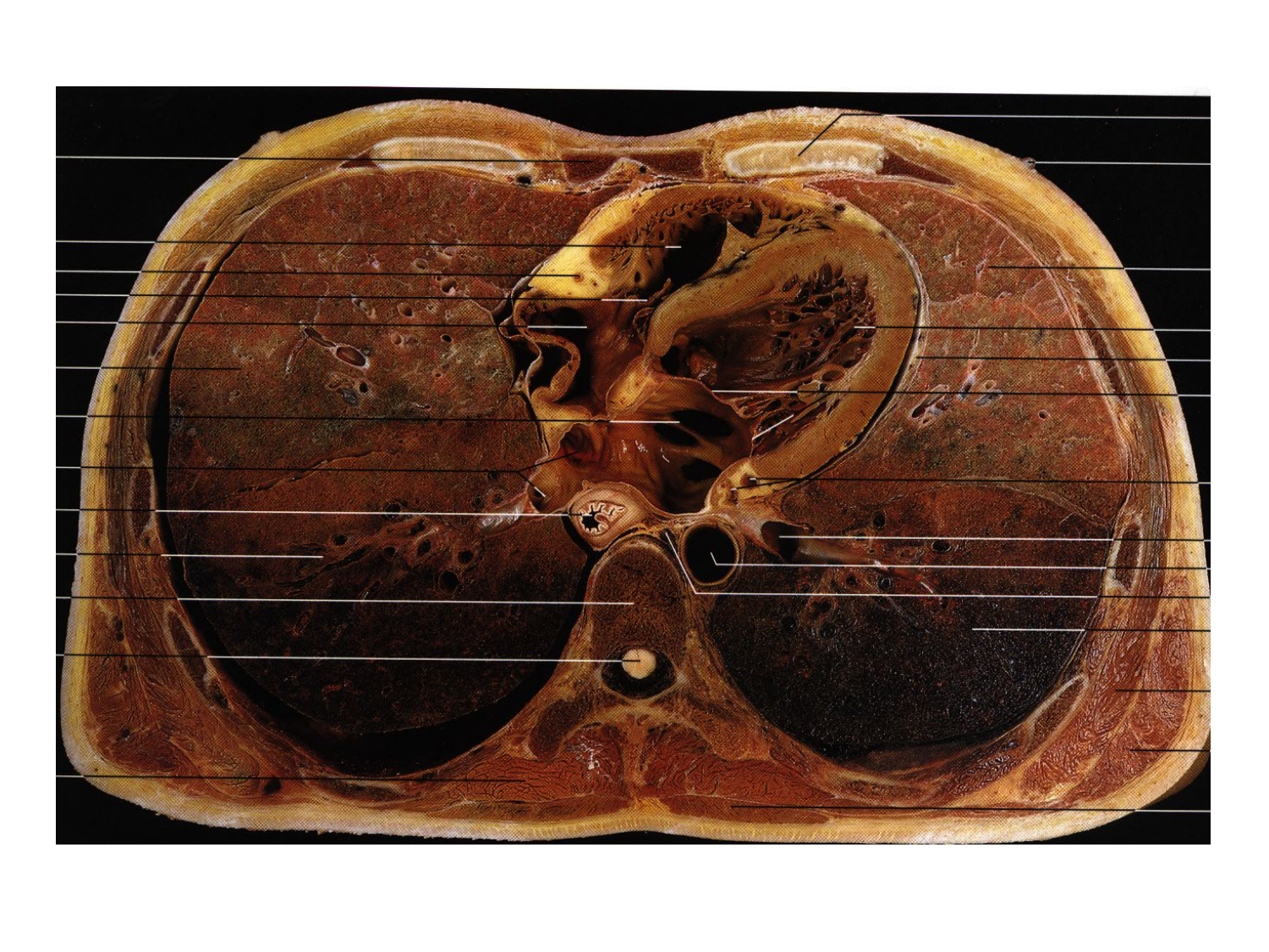 Splanchnologie generale; Pelvis-Perinée système reproducteur (homme et femme)1 page 18