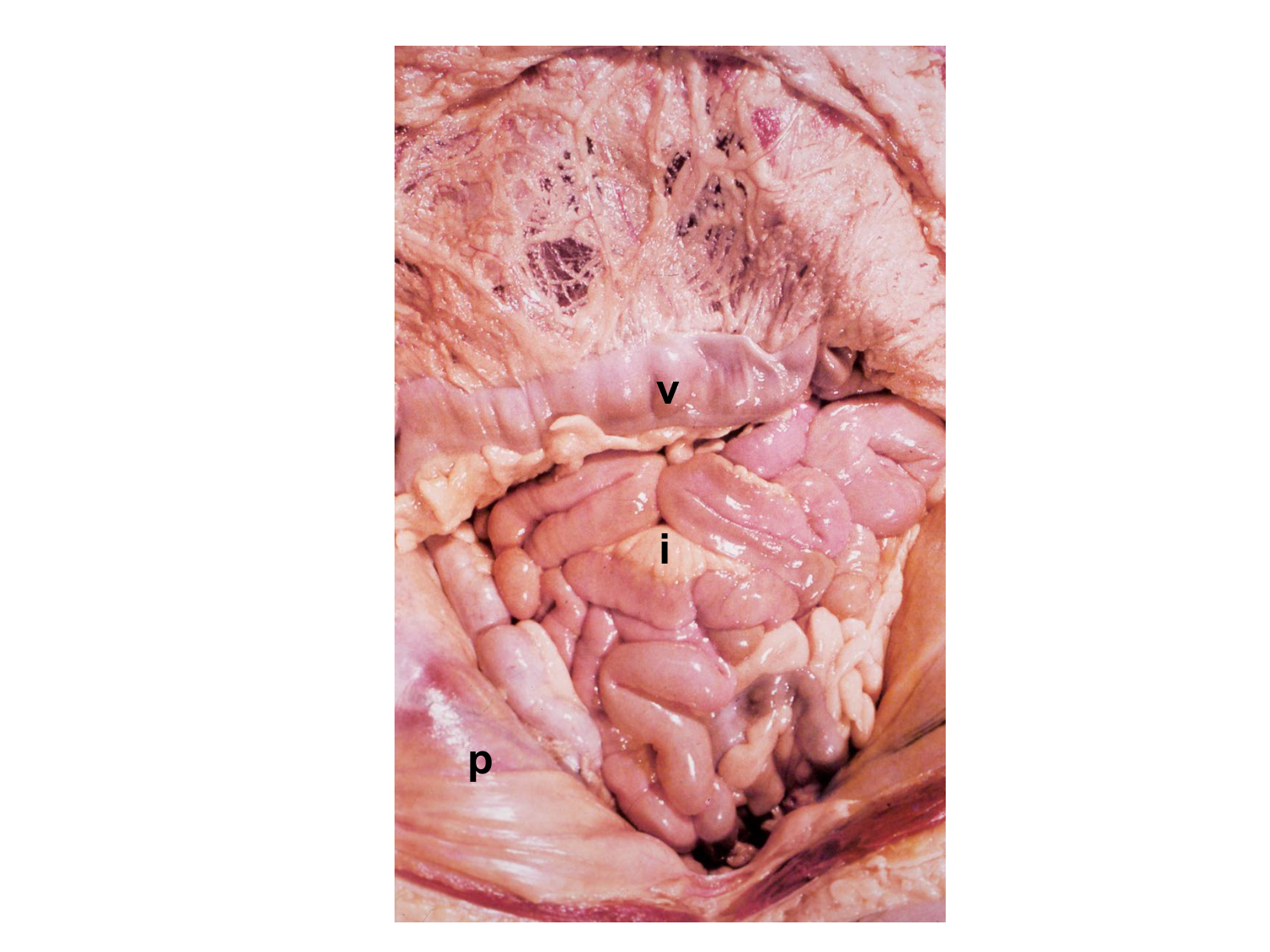 Splanchnologie generale; Pelvis-Perinée système reproducteur (homme et femme)1 page 26